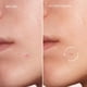 thumbnail image 2 of Pimple Patches MAREE Star para rostro con algas verdes y aceite de árbol de té, 2 of 7