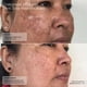 thumbnail image 3 of Crema de Retinol Sente 30 ml Tono y Textura Uniformes, 3 of 9