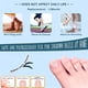 thumbnail image 3 of Kit de tratamiento para uñas encarnadas, aleación de titanio Yin Aawaeao, 3 of 7