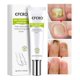 thumbnail image 2 of Elimina Hongos En Uñas Onicomicosis Nueva Formula, 2 of 4
