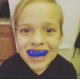 thumbnail image 4 of Protector bucal Oral Mart azul/rojo para niños, karate, fútbol, 4 of 6