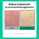 thumbnail image 3 of Pads Tonificantes Cell Fusion C Post Alpha CICA Refrescantes 70 Pads, 3 of 7