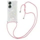 thumbnail image 4 of Funda FOXDOCK para Honor 90 con Cuerda Ajustable, Brillo Líquido, Protección Antigolpes y Lente – Ideal para Regalo, 4 of 6