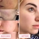 thumbnail image 5 of Mascarilla facial Sand & Sky Australian Pink Clay Porrefining, 5 of 9