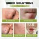 thumbnail image 5 of Mascarilla facial peel off para puntos negros SHVYOG con brocha y aceite de árbol de té, 5 of 9