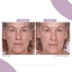 thumbnail image 4 of Sérum facial Serious Skincare Reverse Lift Reverse Lift, 30 ml, 4 of 8