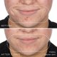 thumbnail image 4 of Sérum Medik8 Niacinamide Peptides 30 mL Piel visiblemente limpia, 4 of 9