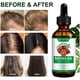 thumbnail image 3 of Aceite de batana KPNEMA, 60 ml, para el crecimiento del cabello y el cuidado de la piel (paquete de 2), 3 of 3