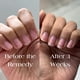 thumbnail image 4 of Esmalte fortalecedor de uñas Botanist The Remedy, 84% a base de plantas, 4 of 8