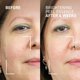 thumbnail image 5 of Esencia exfoliante iluminadora Dr. Brandt Dr. B Lab, 100 ml x 2, 5 of 8