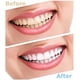 thumbnail image 4 of Puntas de repuesto para chorro de agua dental, accesorios compatibles con Waterpik WP-100, WP-450, WP-660 y WP-900., 4 of 7