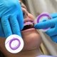 thumbnail image 5 of Paquete de 3 Tiras de Pulido Dental Ceonam 4 mm x 6 m, 5 of 8
