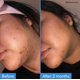 thumbnail image 3 of Good Molecules Pack de 2 Sérums Correctores de Despigmentación – 75 ml / 2.5 fl oz Cada Uno | Sérum Facial Ligero con Ácido Tranexámico y Niacinamida para una Piel de Tono Uniforme, 3 of 8