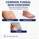 thumbnail image 4 of Crema Antifúngica Miconazol 2% 100 G, 4 of 9