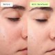 thumbnail image 4 of Bruma Facial Barefaced 120 ml Spray de Ácido Hipocloroso, 4 of 8