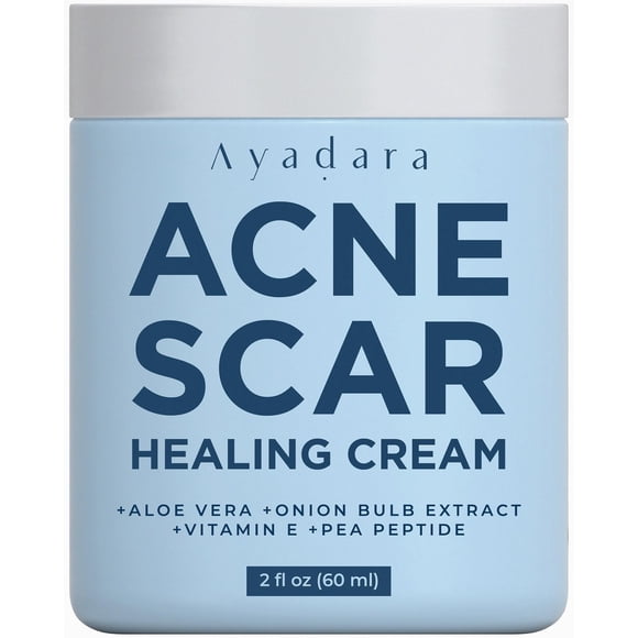 Crema curativa para cicatrices de acné Ayadara 60 ml para rostro y cuerpo