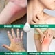 thumbnail image 4 of Crema Plus 1% Hidrocortisona Con Aloe Vera 28 G, 4 of 9