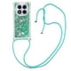 thumbnail image 2 of Funda FOXDOCK para Xiaomi Redmi Note 14 Pro 5G con Cuerda Ajustable, Brillo Líquido, Protección Antigolpes y Lente – Ideal para Regalo, 2 of 6