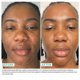 thumbnail image 2 of Sérums faciales Urban Skin Rx Youthhero AM/PM 2 en 1 30 ml, 2 of 7