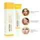 thumbnail image 2 of Acido Salicílico Crema Anti-Acné, 2 of 2