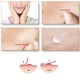 thumbnail image 2 of Set De Parches Coreanos Y Crema Para Las Epinillas -, 2 of 2