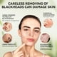 thumbnail image 3 of Mascarilla eliminadora de puntos negros LANBENA Upgraded 2.0 Bamboo Charcoal, 3 of 9