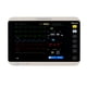 thumbnail image 2 of Monitor De Signos vitales Con Capnografía E Impresora M9, 2 of 9