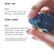 thumbnail image 4 of Serum Age Activist Clinical Youth 30 Ml, 4 of 7