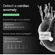 thumbnail image 4 of Báscula WiFi conectada Withings Body Scan BIA Body Comp, 4 of 6