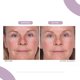 thumbnail image 5 of Sérum facial Serious Skincare Reverse Lift Reverse Lift, 30 ml, 5 of 8