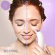 thumbnail image 3 of Extractor de Puntos Negros Essy - Limpiador Facial (Morado), 3 of 9