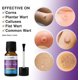 thumbnail image 3 of Removedor de Verrugas y Callos PURESKIN 15ml Ácido Salicílico, 3 of 9