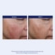 thumbnail image 4 of Sérum antioxidante SuzanObagiMD de Obagi Medical, 30 ml, 4 of 9