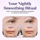 thumbnail image 3 of Parches Antiarrugas Smile Line Face Tape, 3 of 7