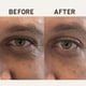thumbnail image 4 of Parches para Ojeras Papatui 6 unidades para Hombre - Anti-Bolsas y Círculos Oscuros, 4 of 9