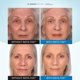 thumbnail image 3 of Sérum Serious Skincare INSTA-TOX Instant Wrinkle 22 ml, 3 of 7