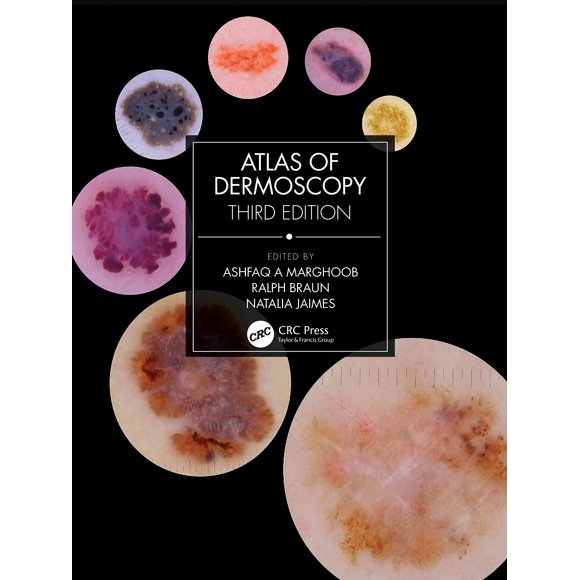 Libro CRC Press Atlas de Dermatoscopia 3ª Edición