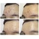 thumbnail image 3 of Sérum Facial de Aloe Vera  Hidratante Antiacne, 3 of 3
