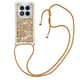 thumbnail image 1 of Funda FOXDOCK para Xiaomi Redmi Note 14 Pro 5G con Cuerda Ajustable, Brillo Líquido, Protección Antigolpes y Lente – Ideal para Regalo, 1 of 6