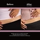 thumbnail image 3 of Tiras Scaraway C-Section Scar Treatment 7 x 1.5 Inch, 3 of 3