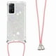 thumbnail image 4 of Funda FOXDOCK para Xiaomi Redmi Note 11 Pro 4G/5G con Cuerda Ajustable, Brillo Líquido, Protección Antigolpes y Lente – Ideal para Regalo, 4 of 6