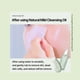 thumbnail image 4 of Herramienta para eliminar puntos negros ILSO Deep Clean Master Silicone, 4 of 6