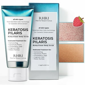 Rida Hair Research Institute - Exfoliante Corporal Kp Bump Eraser, Queratosis Pilaris, Tratamiento Para Mujeres