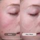 thumbnail image 3 of Sérum Revision Skincare Radiance+ AHA BHA PHA 30 ml, 3 of 9