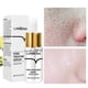 thumbnail image 1 of Sérum LANBENA Esencia facial para el cuidado de los poros, 15 ml, 1 of 6