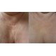 thumbnail image 4 of Sérum rejuvenecedor hialurónico Albertini 100 ml con vitamina B5, 4 of 5