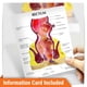 thumbnail image 5 of Modelo de Recto Humano GPI Anatomicals con Patologías, 5 of 6