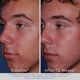 thumbnail image 2 of Set de cuidado de la piel Obagi Medical ClenziDerm M.D. System, paquete de 1, 2 of 3