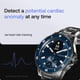 thumbnail image 3 of Smartwatch Withings Scanwatch Nova con frecuencia cardíaca, SpO2 y temperatura, 3 of 6