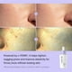 thumbnail image 4 of Sérum facial REJURAN® Ampoule para minimizar poros 30 mL, skincare coreano, 4 of 7